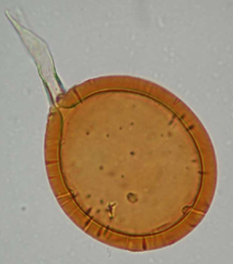 Fig. 1. Vesícula o espora característica de una micorriza (Glomus sp.) observada por microscopio.