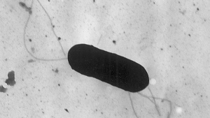 10 factores a tomar en cuenta al elaborar un plan de control de Listeria